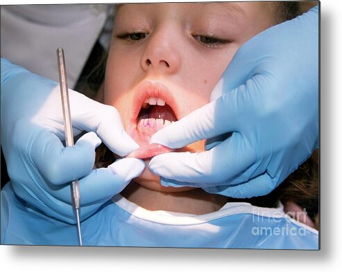 Care Metal Print featuring the photograph Dental Examination #1 by Hannah Gal/science Photo Library