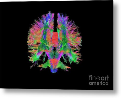 Brain Metal Print featuring the photograph Brain Fibres Front View by Do Tromp/science Photo Library