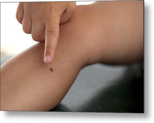 Child Metal Print featuring the photograph A mosquito on small kid's leg by Thanasis Zovoilis