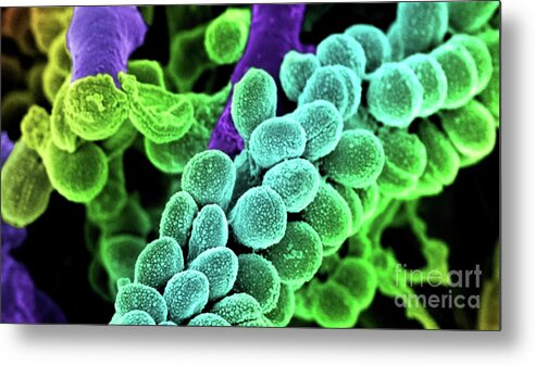 Streptococcus Bacteria Metal Print featuring the photograph Streptococcus Bacteria - Colored scanning electron micrograph. by Doc Braham
