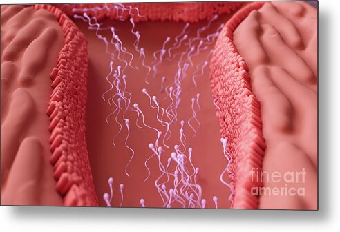 Artwork Metal Print featuring the photograph Sperm Cells Travelling To Fertilise An Egg by Design Cells/science Photo Library