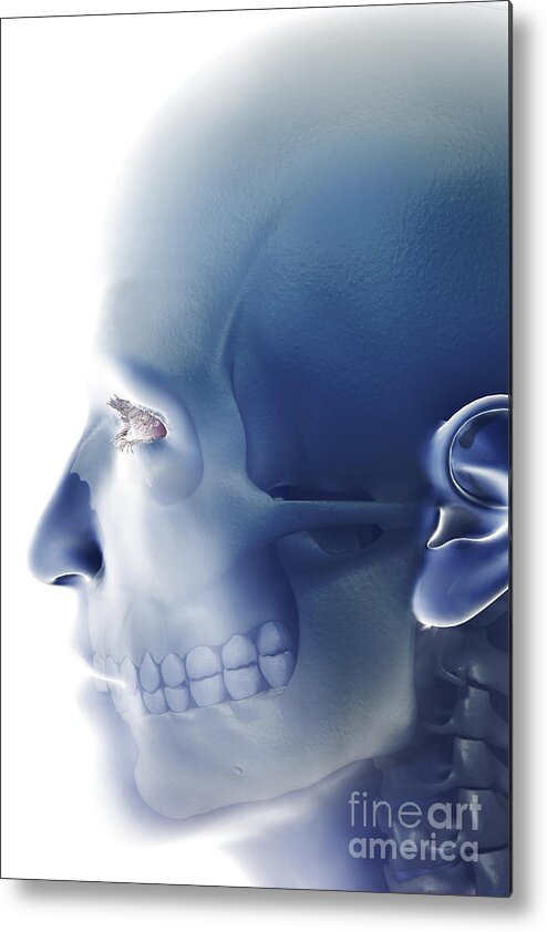 Eye Socket Metal Print featuring the photograph Bones Of The Face #3 by Science Picture Co