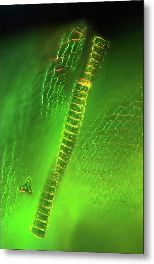 Alga Metal Print featuring the photograph Desmid On Sphagnum Moss #8 by Marek Mis