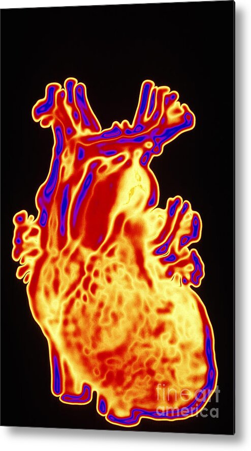 Computer Enhanced Heart Metal Print featuring the photograph Computer Enhanced Heart by Scott Camazine