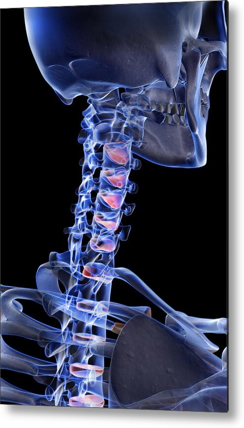 Vertical Metal Print featuring the digital art The Bones Of The Neck #2 by MedicalRF.com