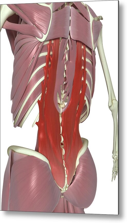 Vertical Metal Print featuring the photograph Muscles Of The Back by MedicalRF.com