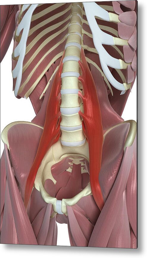 Vertical Metal Print featuring the photograph Psoas Major by MedicalRF.com