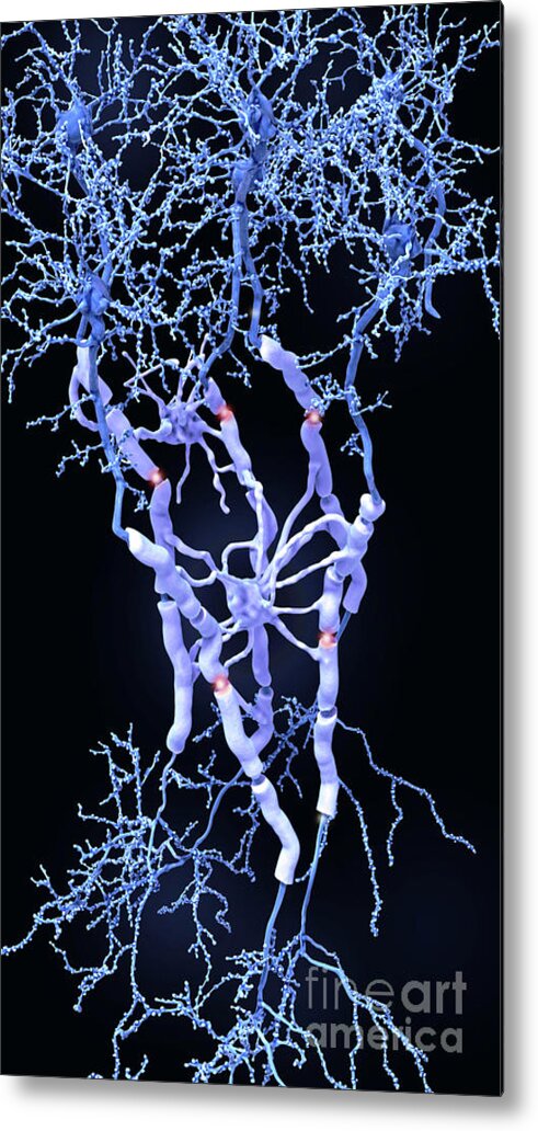 Neuron Metal Print featuring the photograph Neurons And Myelin Sheaths by Juan Gaertner/science Photo Library