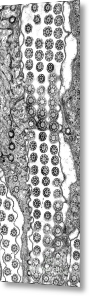 Ciliate Metal Print featuring the photograph Cilia and Basal Bodies TEM by Greg Antipa