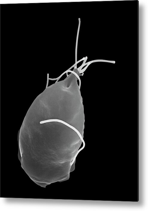 21068a Metal Print featuring the photograph Giardia Lamblia #1 by Dennis Kunkel Microscopy/science Photo Library