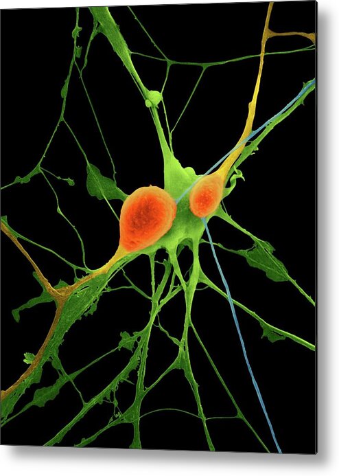 Neuron Metal Print featuring the photograph Pyramidal Neurons From Cns #1 by Dennis Kunkel Microscopy/science Photo Library