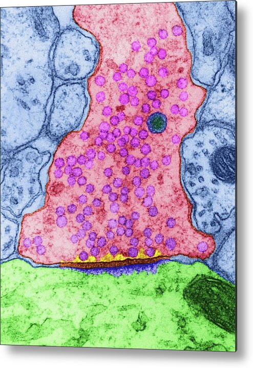 Axon Metal Print featuring the photograph Excitatory Synapse Cns #2 by Dennis Kunkel Microscopy/science Photo Library