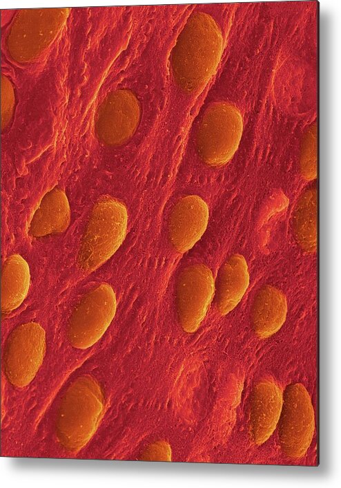 Cardiac Metal Print featuring the photograph Heart Pericardium Surface #4 by Dennis Kunkel Microscopy/science Photo Library