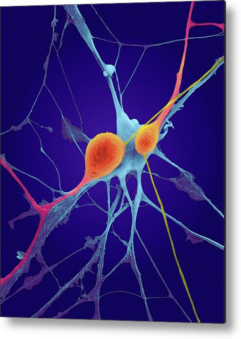 Neuron Metal Print featuring the photograph Pyramidal Neurons From Cns #4 by Dennis Kunkel Microscopy/science Photo Library