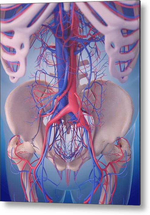 Artwork Metal Print featuring the photograph Vascular System Of Abdomen #5 by Sebastian Kaulitzki/science Photo Library