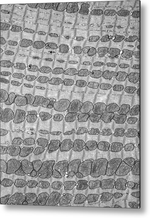 Tissue Metal Print featuring the photograph Cardiac Muscle by Microscape