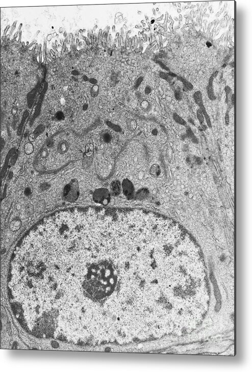 Eukaryote Metal Print featuring the photograph Epithelial Cell, Tem by David M. Phillips