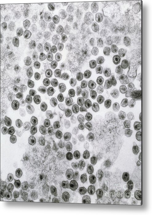 Hiv Metal Print featuring the photograph Hiv Virus by David M. Phillips