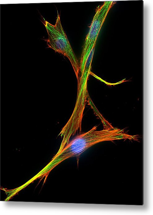 Biological Metal Print featuring the photograph Fibroblast Cells, Fluorescent Micrograph #3 by Dr Torsten Wittmann