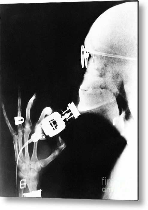 Electric Razor Metal Print featuring the photograph X-ray Of Man Shaving With Electric Razor by Bettmann