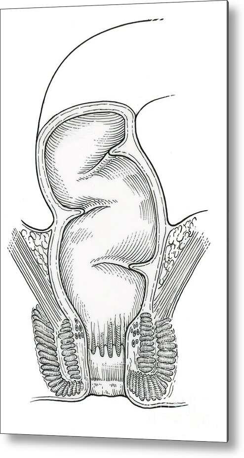 Anatomy Metal Print featuring the photograph Illustration Of Rectum #7 by Science Source