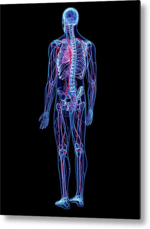 Artwork Metal Print featuring the photograph Vascular System #1 by Sebastian Kaulitzki/science Photo Library