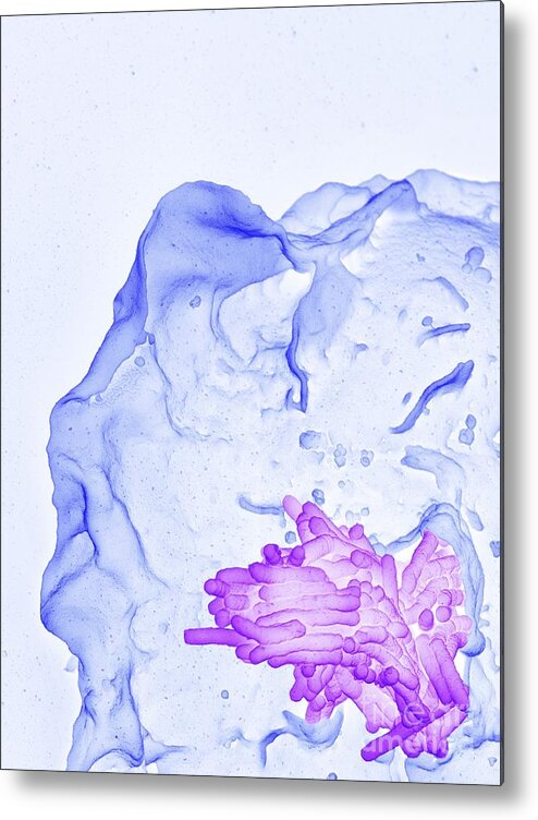 Mycobacterium Tuberculosis Metal Print featuring the photograph Macrophage Engulfing Tb Bacteria, Sem #2 by Science Photo Library