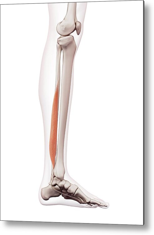 Artwork Metal Print featuring the photograph Human Leg Muscles #31 by Sebastian Kaulitzki/science Photo Library