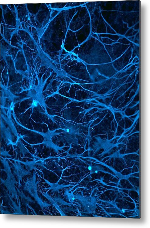 Biological Metal Print featuring the photograph Stem cell-derived nerve cells by Science Photo Library