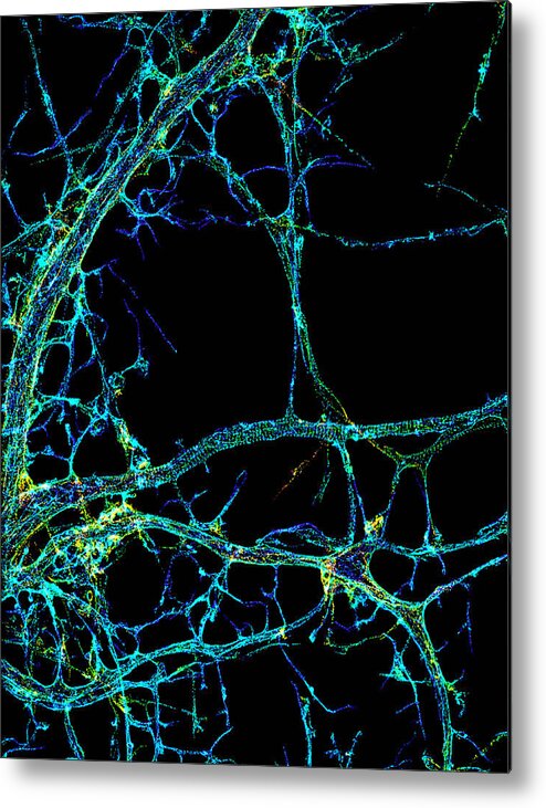 Science Metal Print featuring the photograph Axonal Cytoskeleton, Storm Image by Science Source