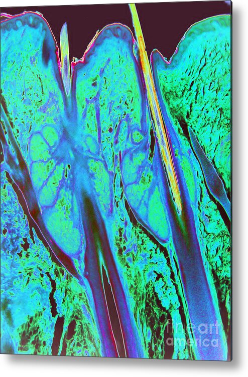 Hair Metal Print featuring the photograph Hair Follicles Lm by Garry DeLong