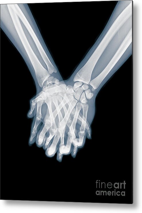 Romance Metal Print featuring the photograph Holding Hands x-ray by Guy Viner