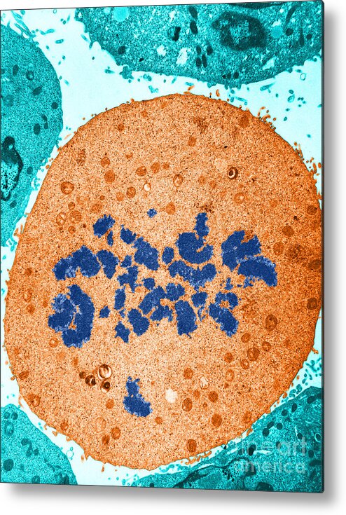 Eukaryote Metal Print featuring the photograph Mitosis, Prometaphase, Tem by David M. Phillips