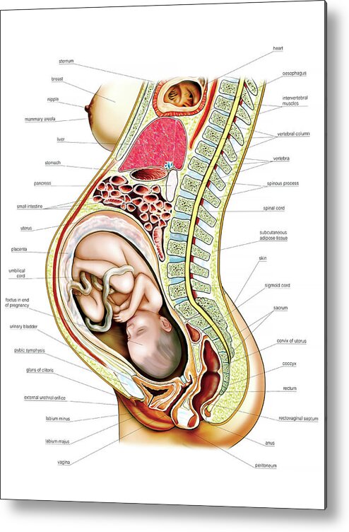 Anatomy Metal Print featuring the photograph Pregnant Woman by Asklepios Medical Atlas