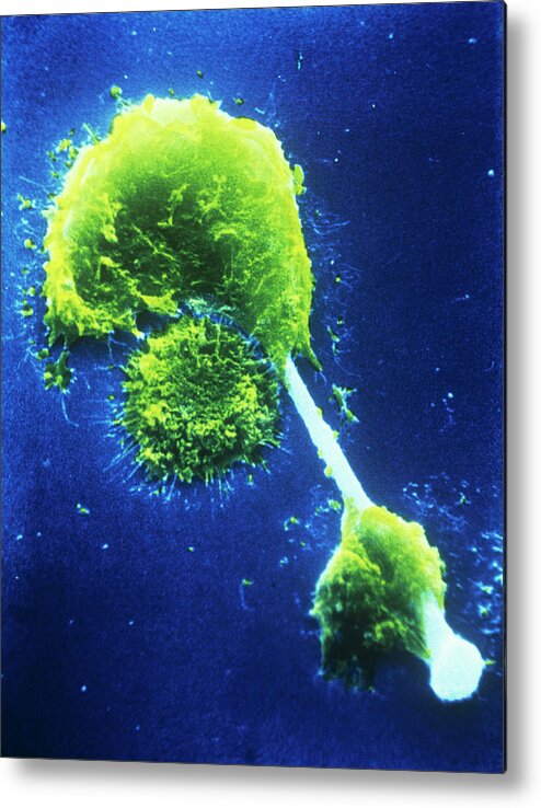 Magnified Image Metal Print featuring the photograph Sem Of Macrophages Impaled On An Asbestos Needle by Photo Insolite Realite/science Photo Library
