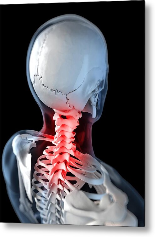 Vertical Metal Print featuring the digital art Neck Pain, Conceptual Artwork #6 by Sciepro