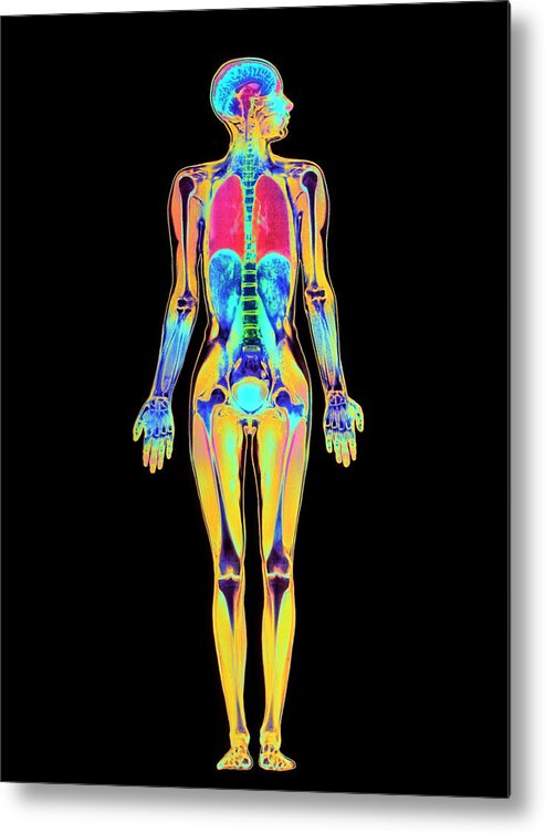 Whole Body Metal Print featuring the photograph Coloured Mri Scan Of A Whole Human Body (female) #1 by Simon Fraser/science Photo Library