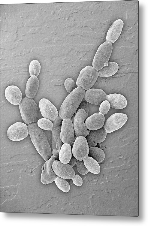 2121029 Metal Print featuring the photograph Zygosaccharomyces Bailii Yeast #1 by Dennis Kunkel Microscopy/science Photo Library