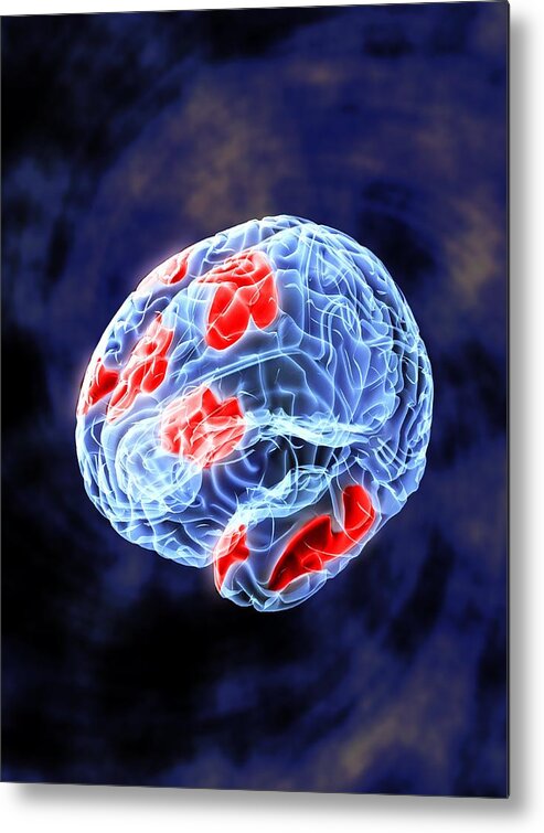 Brain Metal Print featuring the photograph Brain Activity, Artwork by Equinox Graphics