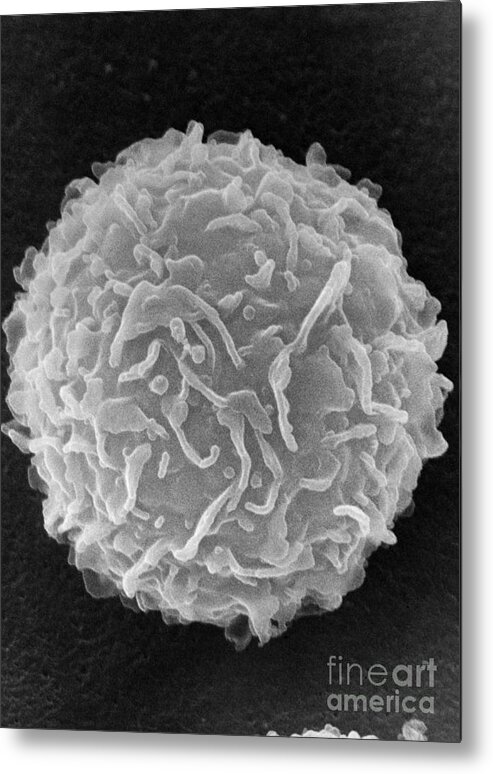Biology Metal Print featuring the photograph Mast Cell SEM by Don Fawcett and E Shelton and Photo Researchers