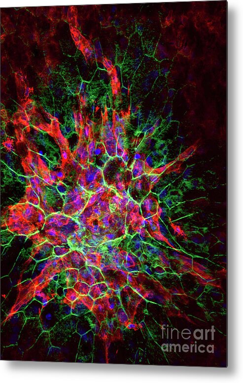 Nobody Metal Print featuring the photograph Choroidal Neovascularisation by Sonia Samtani, Juan Amaral, Mercedes Campos, Robert Fariss, Patricia Becerra, National Eye Institute, National Institutes Of Health/science Photo Library