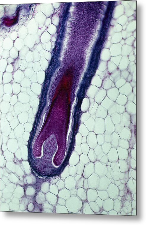 People Metal Print featuring the photograph Hair Follicle, Hair Bulb, and Hair Papilla, Human Scalp, 25X at 35mm. Growth takes place at the base of the hair follicle. Adipose tissue surrounds the hair bulb. by Ed Reschke