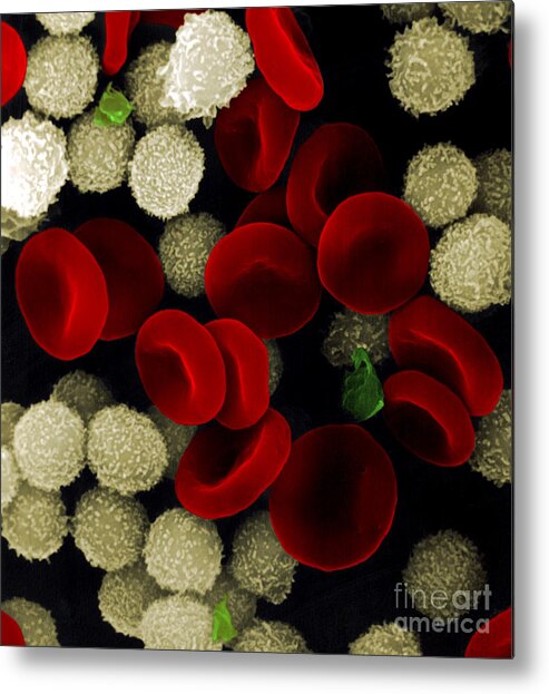 Leukocyte Metal Print featuring the photograph Blood Cells by Stem Jems
