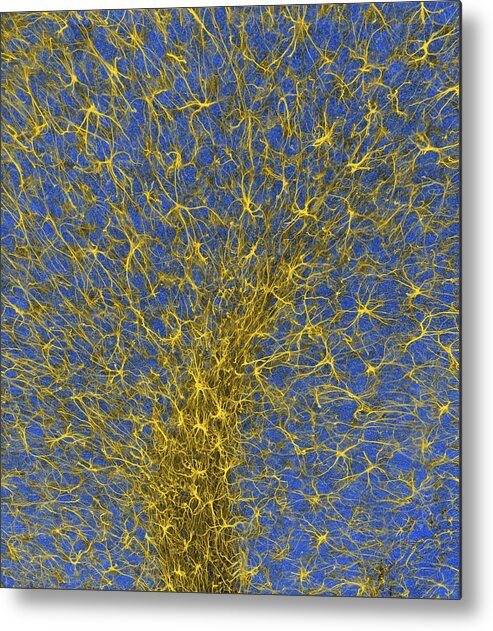 Glial Cell Metal Print featuring the photograph Glial Cells #2 by Thomas Deerinck, Ncmir