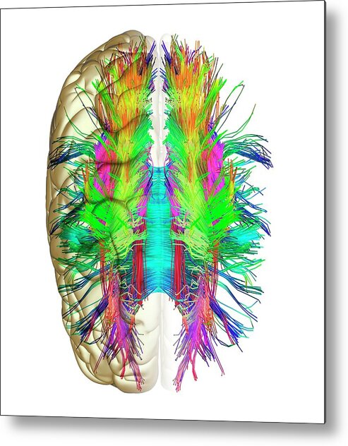 Brain Metal Print featuring the photograph White Matter Fibres And Brain #5 by Alfred Pasieka