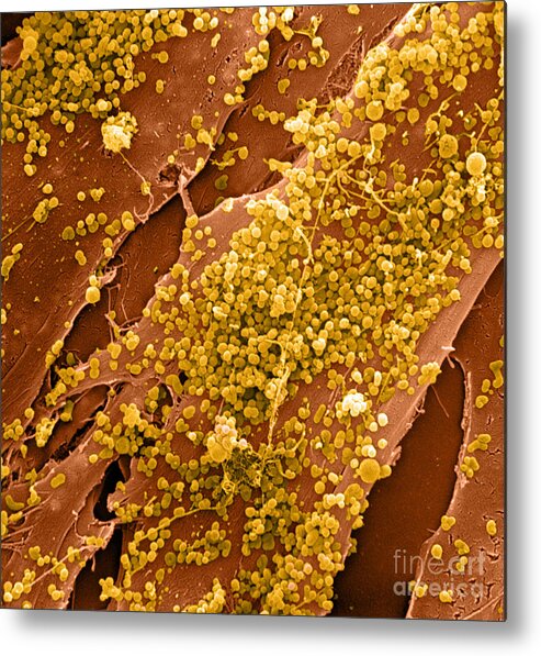 Cell Metal Print featuring the photograph Human Skin Cell Sem by David M. Phillips
