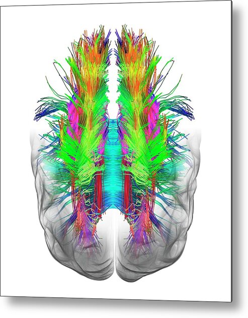 Brain Metal Print featuring the photograph White Matter Fibres And Brain #6 by Alfred Pasieka
