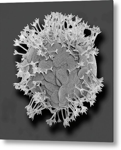 Acanthocystis Metal Print featuring the photograph Acanthocystis by Steve Gschmeissner/science Photo Library