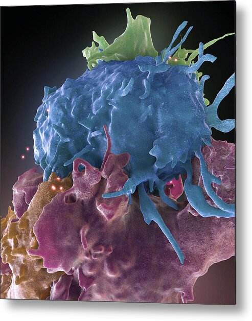 Science Metal Print featuring the photograph Hiv-infected And Normal T Cells by Science Source