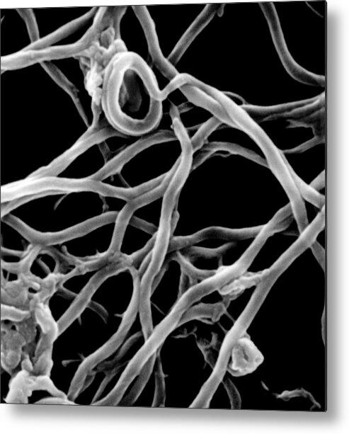 Bacteria Metal Print featuring the photograph Lyme Disease, Sem by Stem Jems